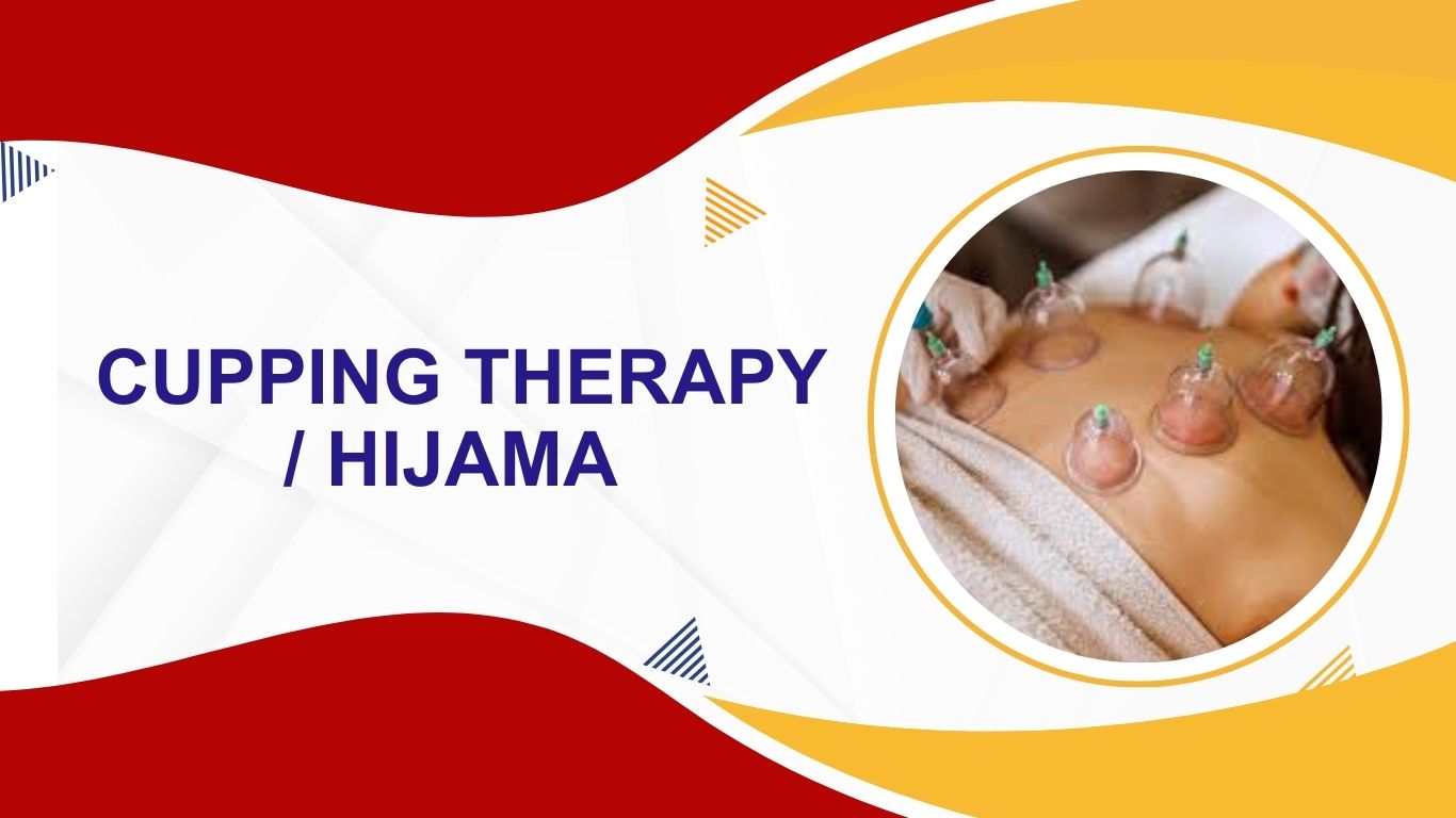 Cupping Hijama
